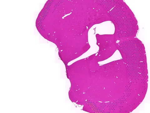 Mouse brain preview