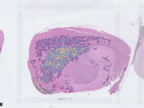 Mouse brain preview