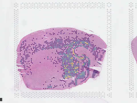 Mouse brain preview