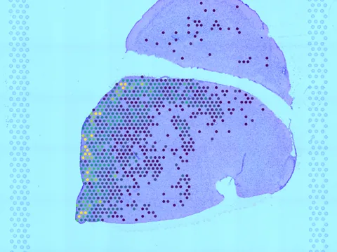 Mouse brain preview
