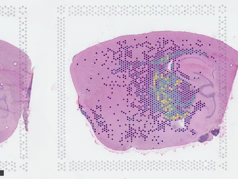 Mouse brain preview