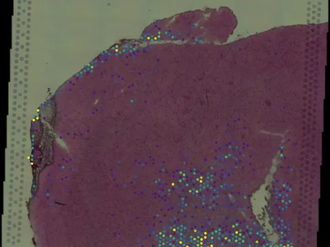 Human brain preview