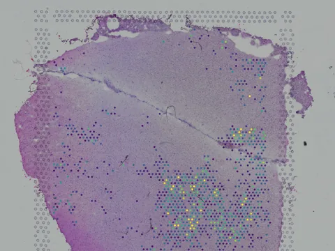 Human brain preview