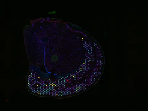 Mouse brain preview