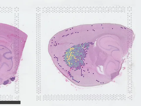 Mouse brain preview