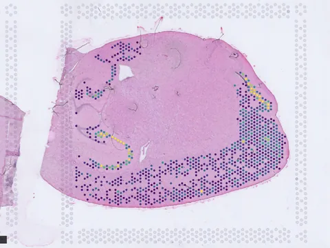 Mouse brain preview