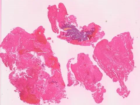 Human brain preview