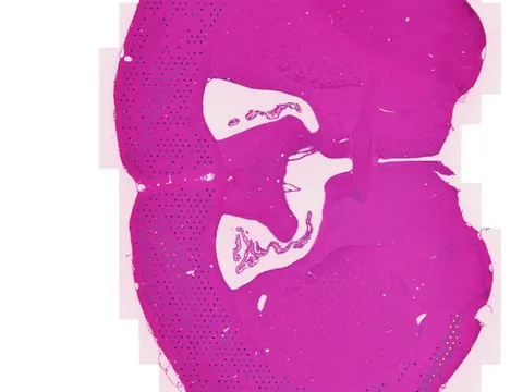 Mouse brain preview