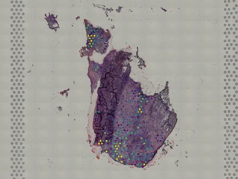 Human brain preview