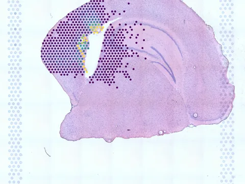 Mouse brain preview