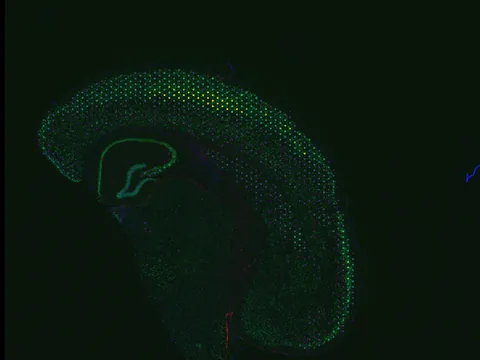 Mouse brain preview