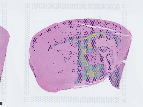 Mouse brain preview