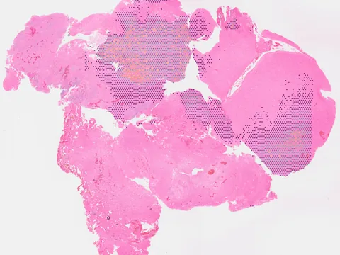 Human brain preview