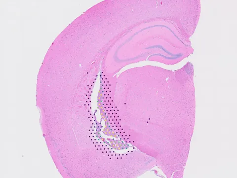 Mouse brain preview