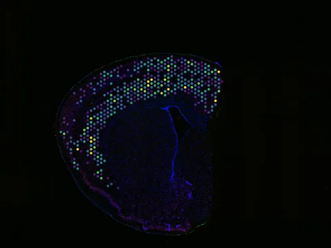 Mouse brain preview