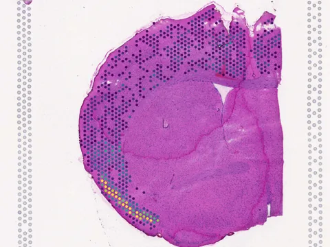 Mouse brain preview