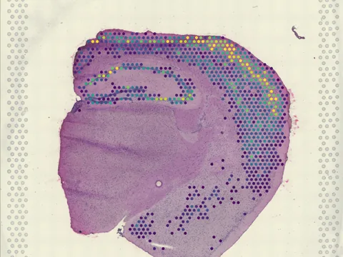 Mouse brain preview