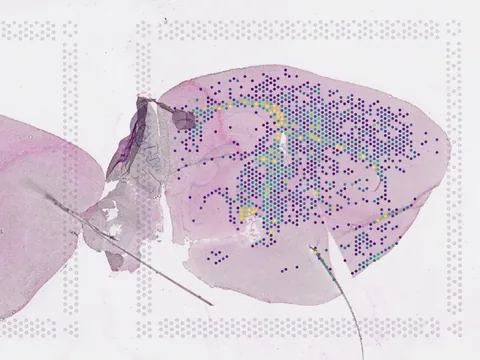 Mouse brain preview