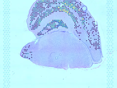 Mouse brain preview