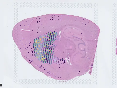 Mouse brain preview