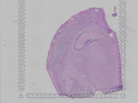 Mouse brain preview