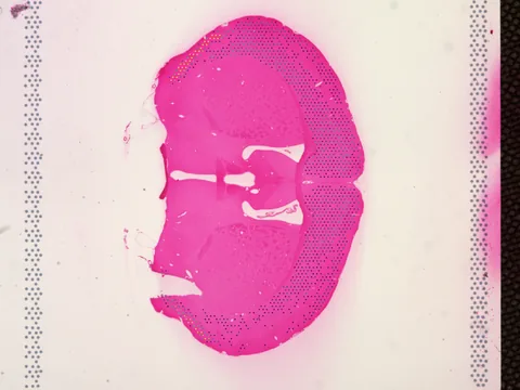 Mouse brain preview