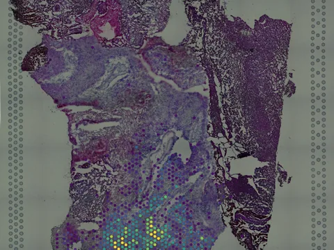 Human brain preview