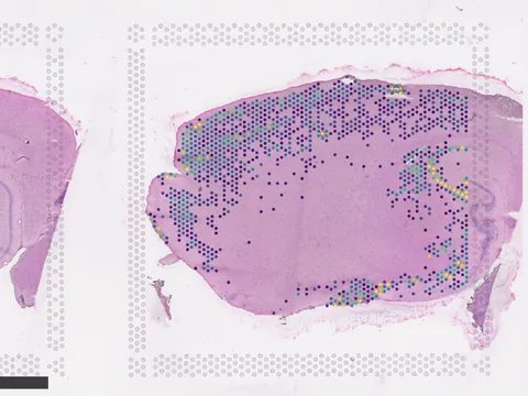 Mouse brain preview