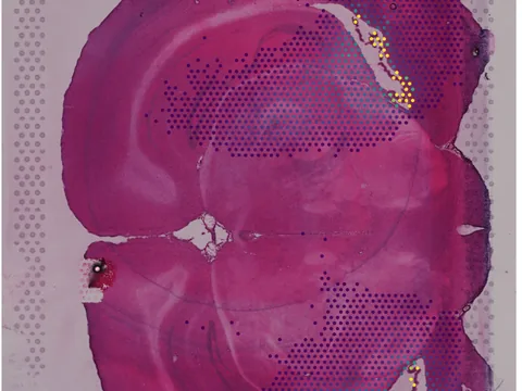 Mouse brain preview