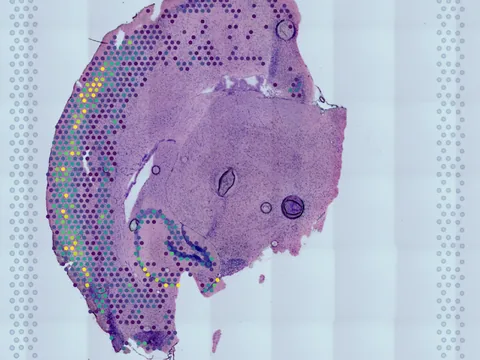 Mouse brain preview