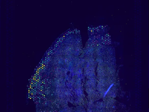 Mouse brain preview