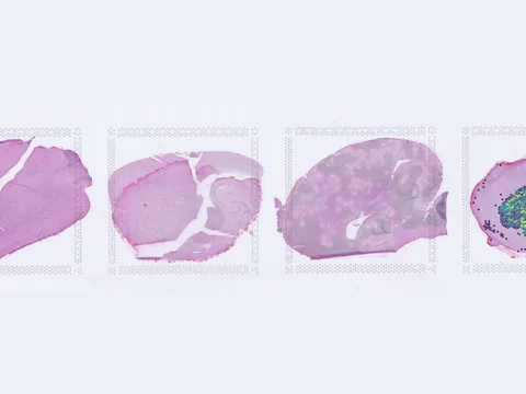 Mouse brain preview