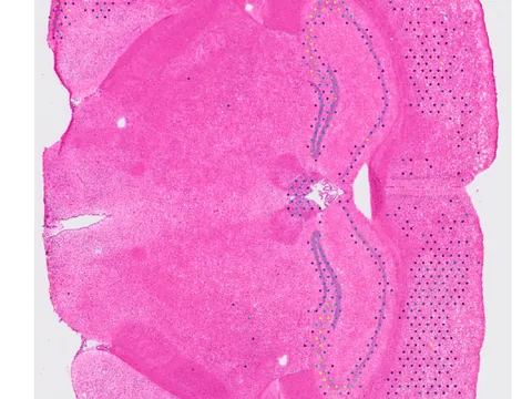 Mouse brain preview