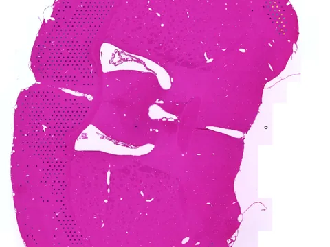 Mouse brain preview