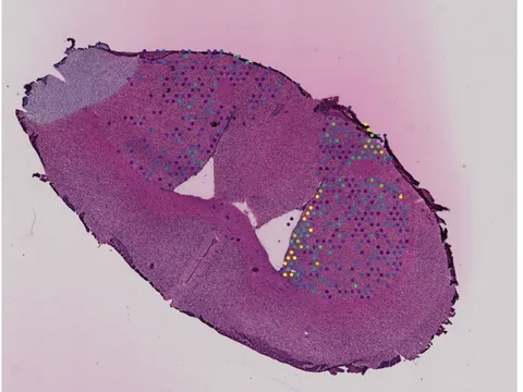 Mouse brain preview