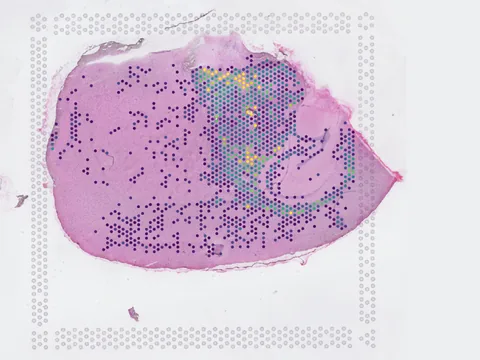 Mouse brain preview