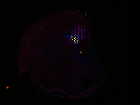 Mouse brain preview