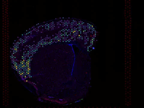 Mouse brain preview