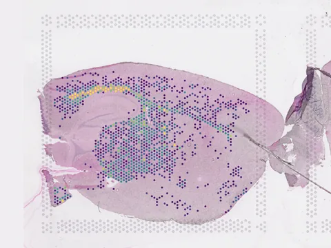 Mouse brain preview