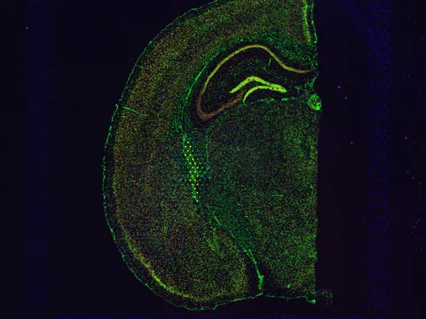 Mouse brain preview