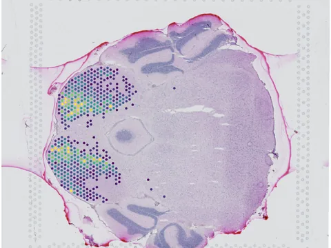 Mouse brain preview
