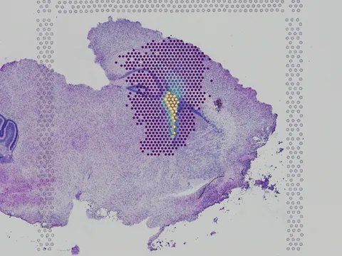 Mouse brain preview
