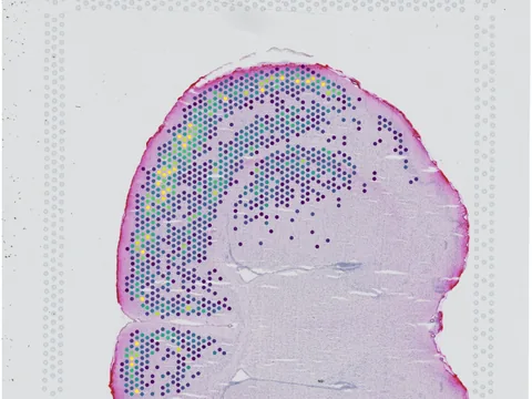 Mouse brain preview