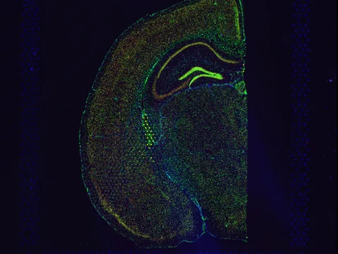 Mouse brain preview