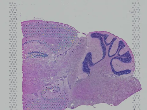 Mouse brain preview