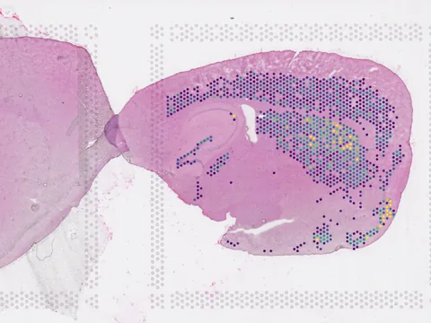Mouse brain preview