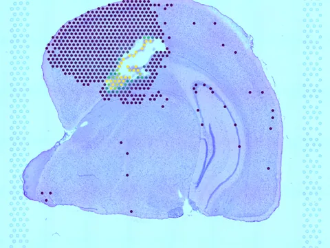 Mouse brain preview