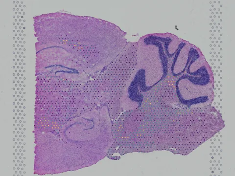 Mouse brain preview