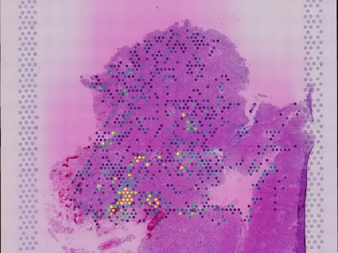 Human brain preview