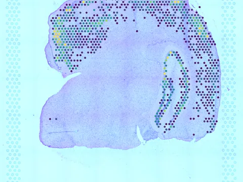 Mouse brain preview